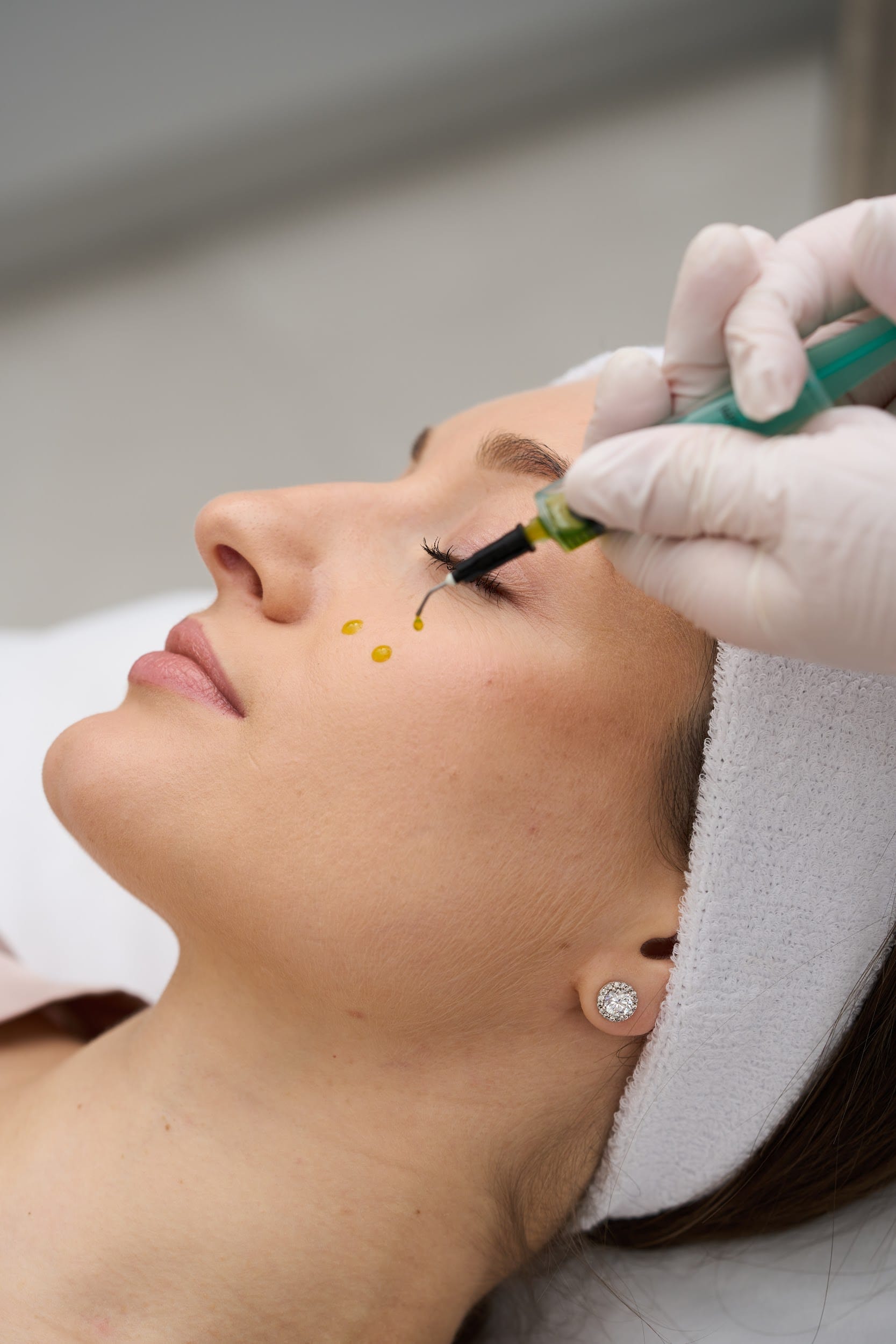 BioRePeelCl3 treatment at Robin's Day Spa