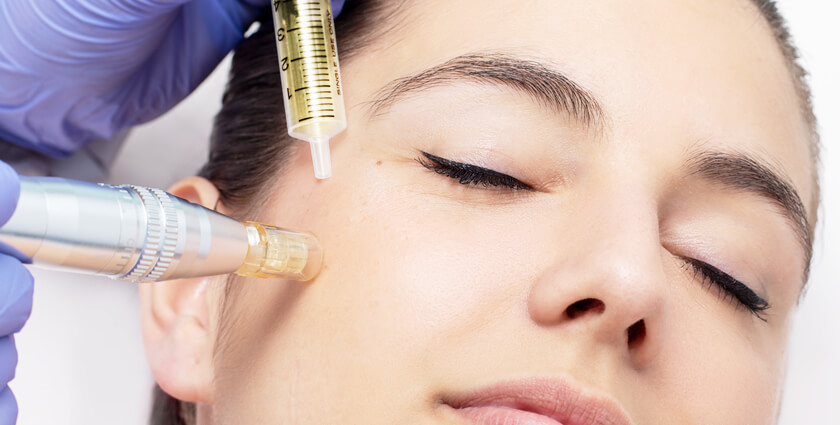 Mesotherapy treatment at Robin's Day Spa