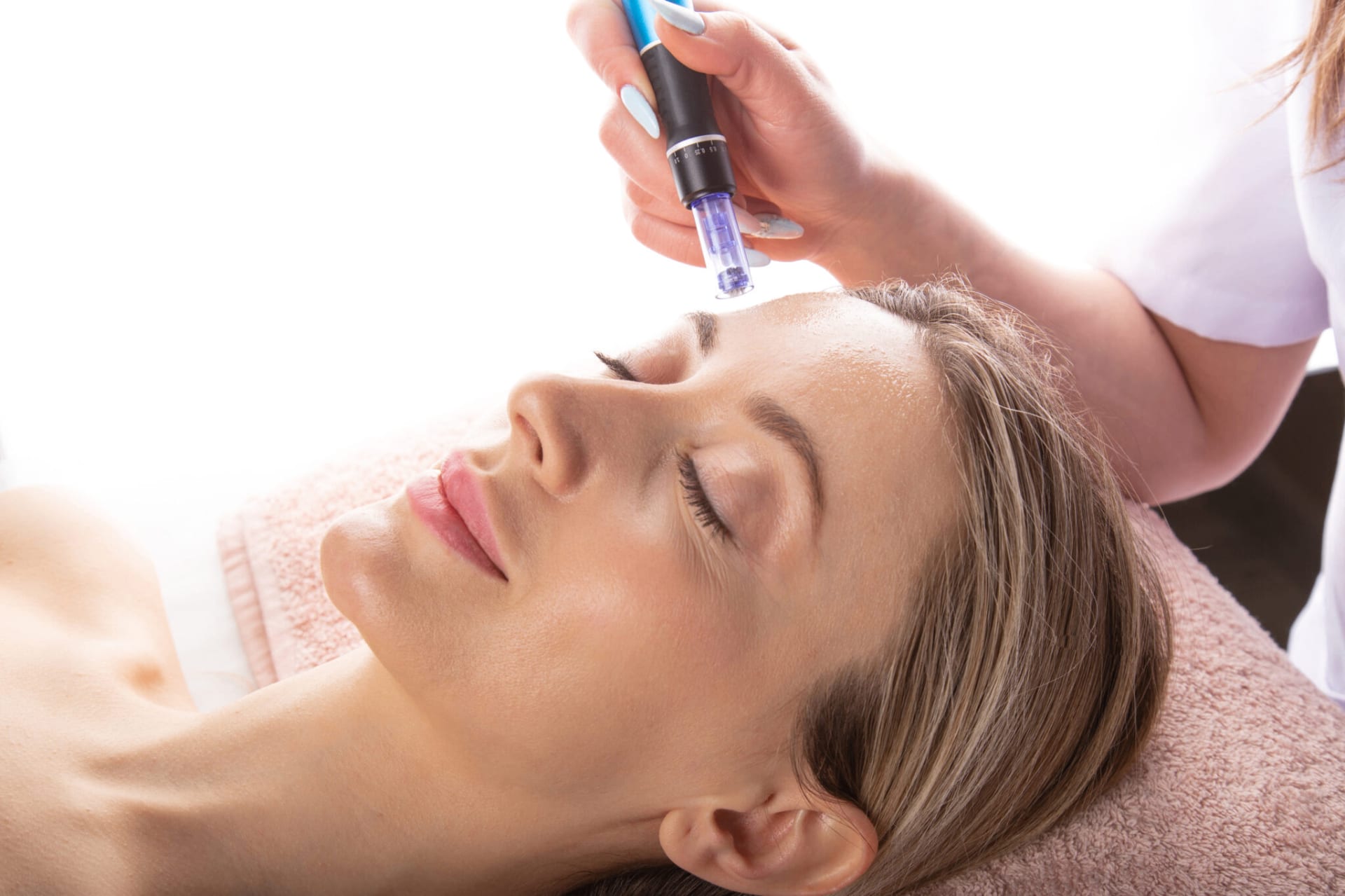 Micro-Needling treatment at Robin's Day Spa